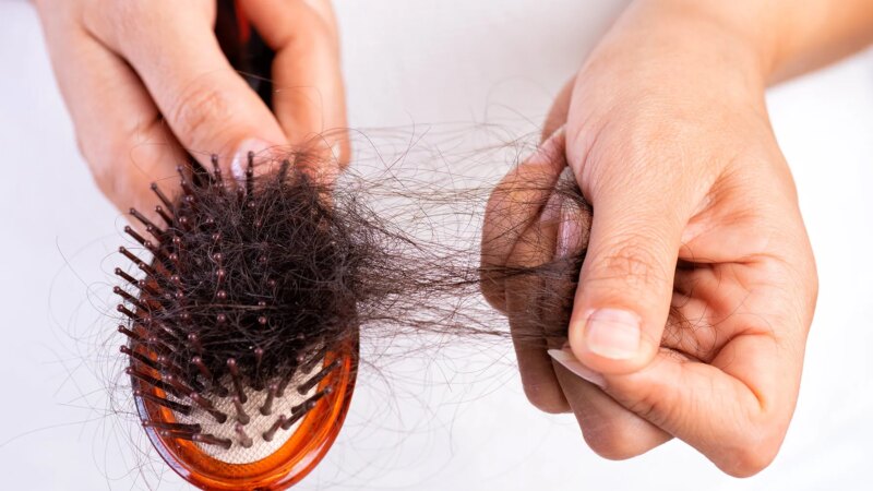 Sometimes Hair Loss in Women Can Point to Bigger Health Issues