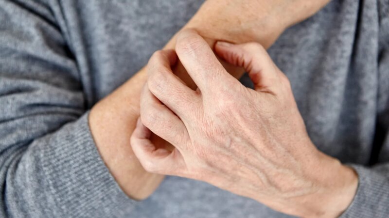 Skin Issues Can Be First Sign of Rheumatological Illnesses