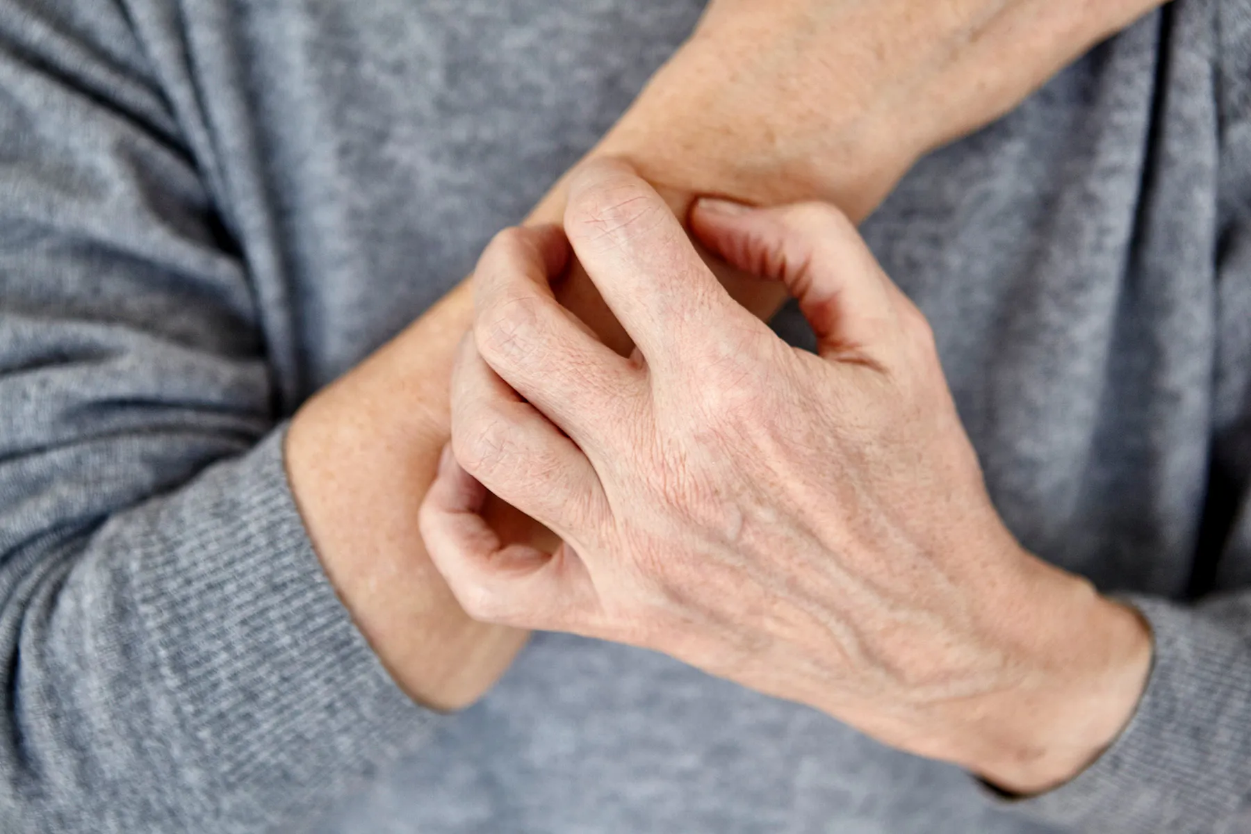 Skin Issues Can Be First Sign of Rheumatological Illnesses