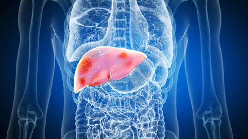 Can ChatGPT Help Adults Manage Their Liver Disease?