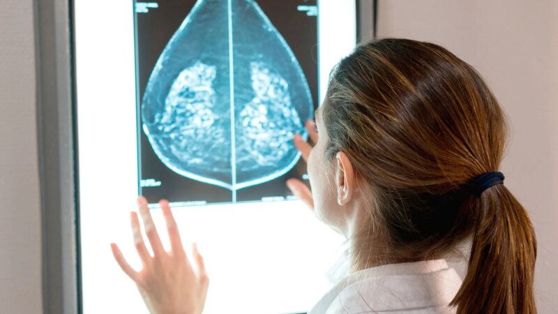 Federal Task Force Suggest Mammograms Start at 40, Not 50