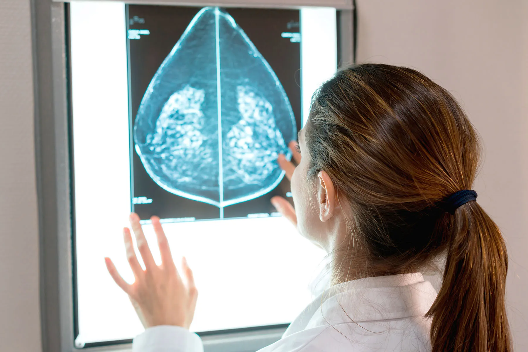 Federal Task Force Suggest Mammograms Start at 40, Not 50