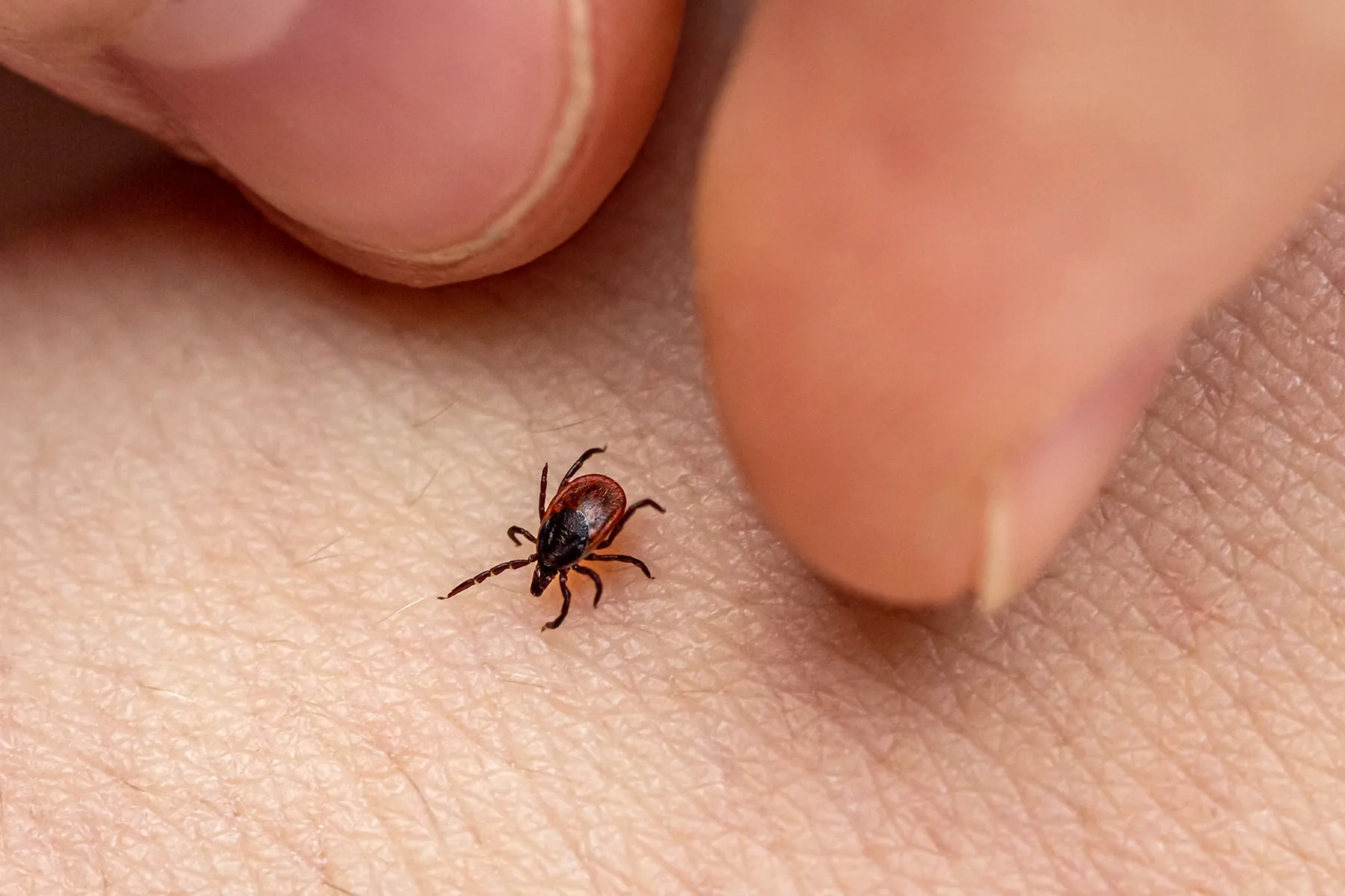 Tick-Borne Powassan Virus Can Kill — How to Protect Yourself