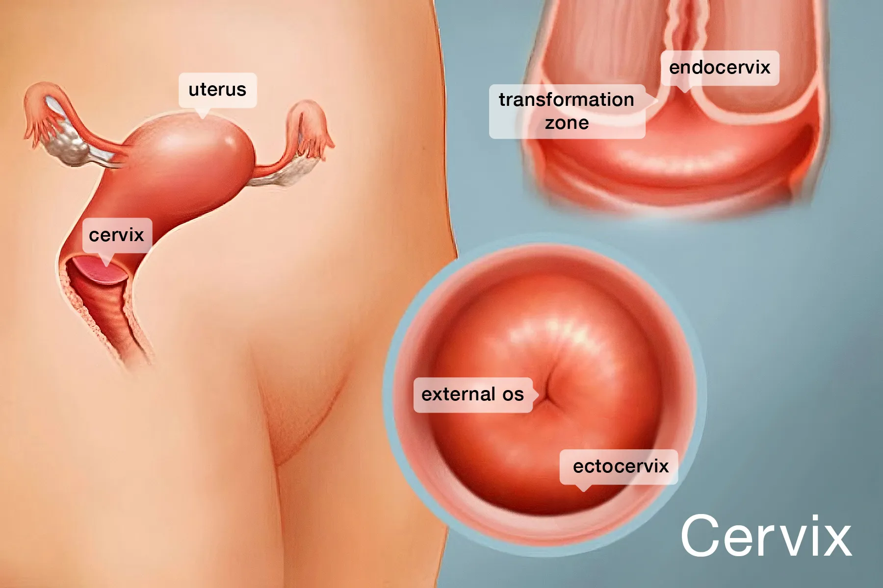 Cervical Cancer Screenings Double With Mailed DIY Kits