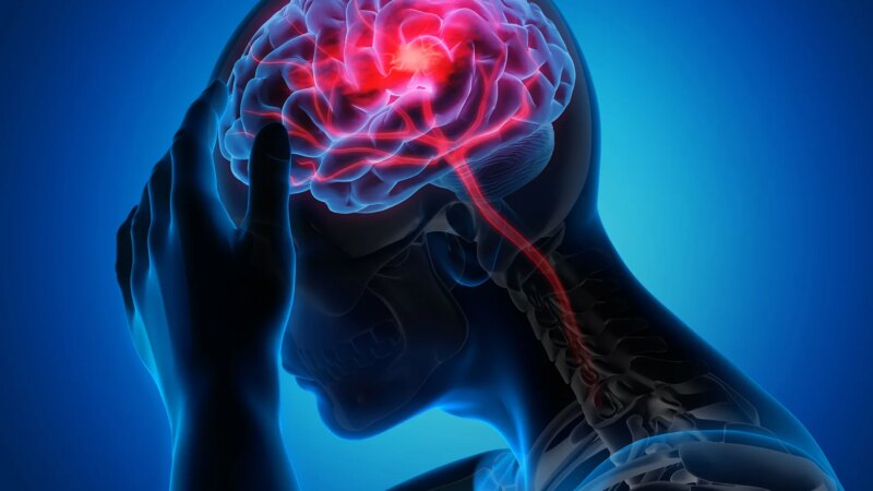 Time and Support Key for Younger Stroke Patients