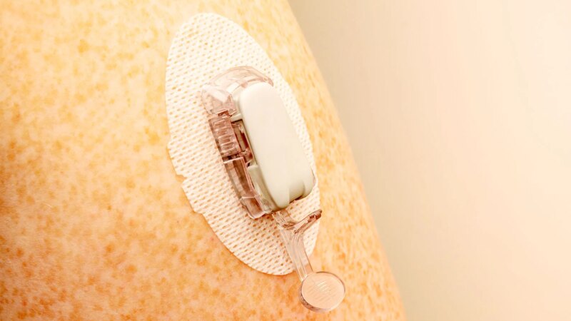 Are Glucose Monitors for Those Without Diabetes a Good Idea?