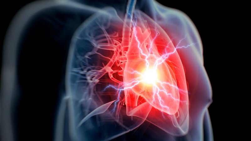 Chest Pain and Other Signs