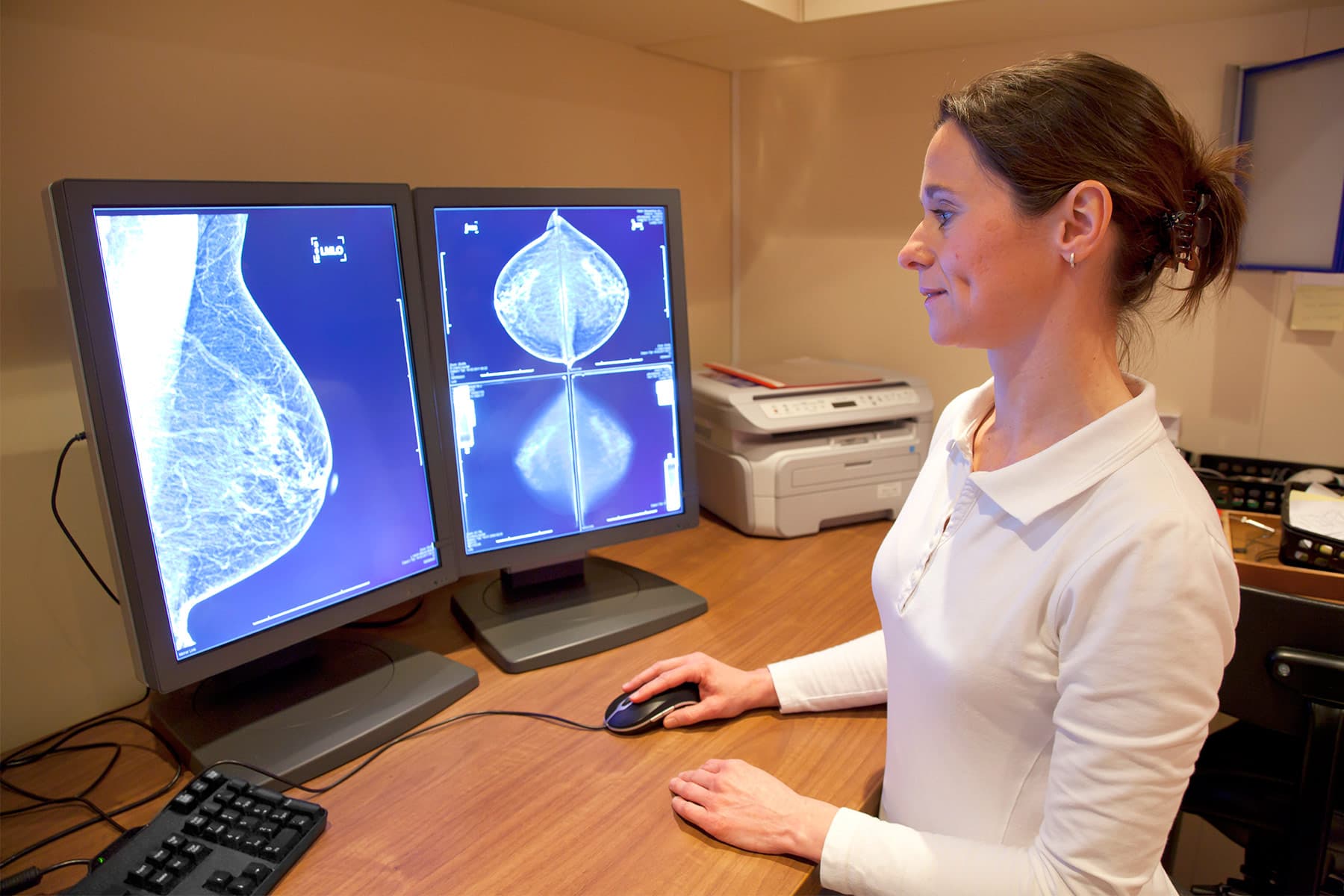 Are Transgender People at Risk of Breast Cancer?