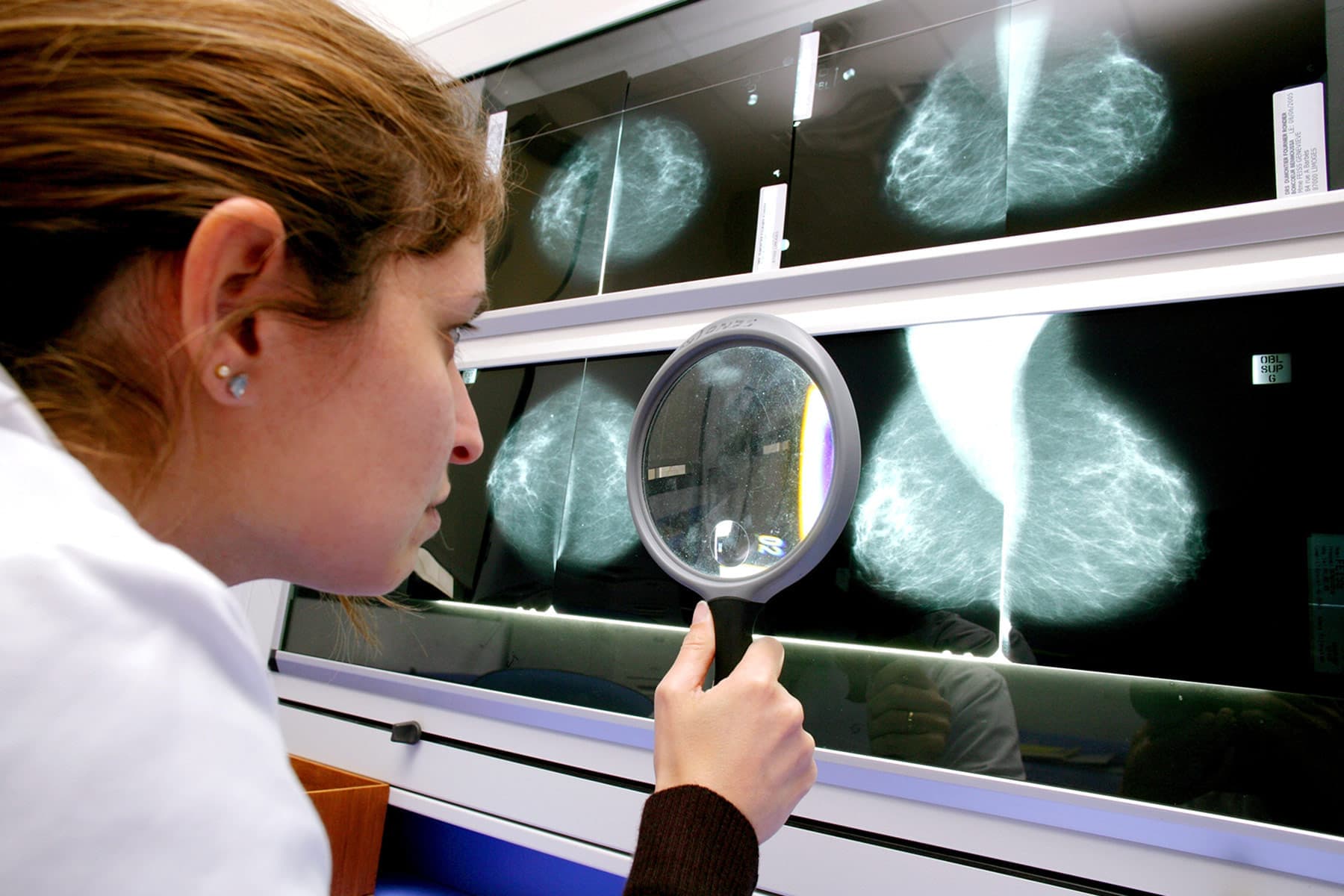Common Chemicals: Breast Cancer Link?
