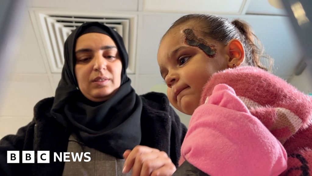 BBC joins Gazan girl, 2, on leg of trip to Jordan for life-saving treatment