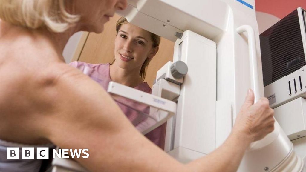 Major breast cancer screening AI trial to begin