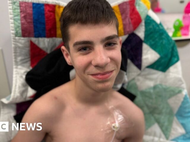 Essex teenager left unable to eat due to rare digestive condition